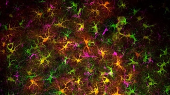 Un grupo reducido de células