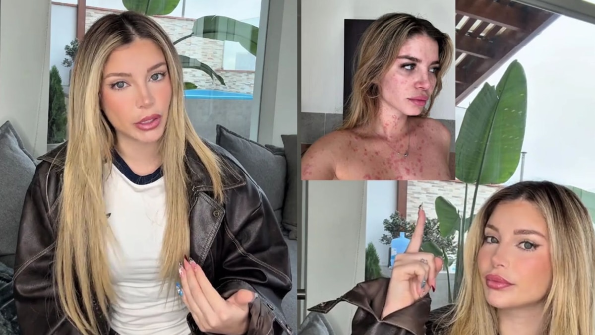 Flavia Laos confiesa que padece enfermedad incurable: “Mi cuerpo comenzó a hablar por sí solo” - Infobae