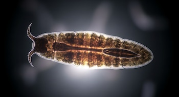 El hallazgo de Heterobilharzia americana