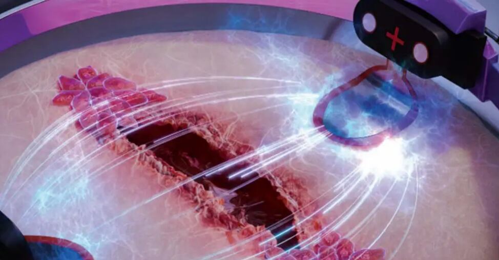 Científicos de Trinity College Dublín logran reprogramar macrófagos con electricidad para acelerar la curación de heridas (Science Brush)