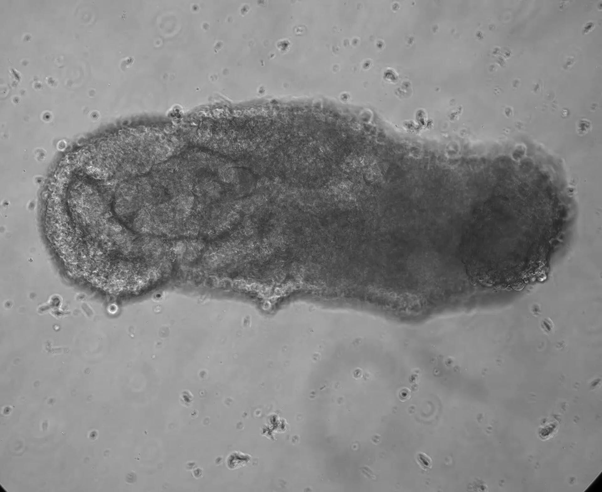La osteogénesis imperfecta, enfermedad genética que causa huesos frágiles y deformidades, encuentra una nueva esperanza en la terapia celular avanzada (Créditos: Jitesh Neupane, University of Cambridge)