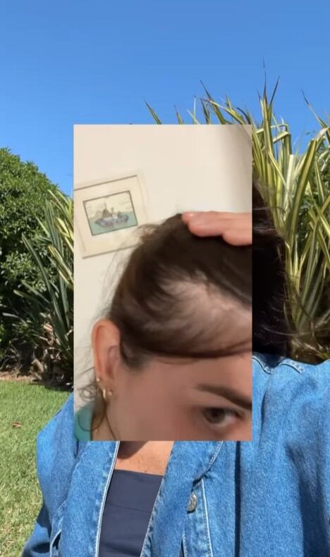 Korina Rivadeneira revela que la caída masiva de su cabello fue la señal que la llevó a descubrir su enfermedad. Infobae Perú / Captura: IG