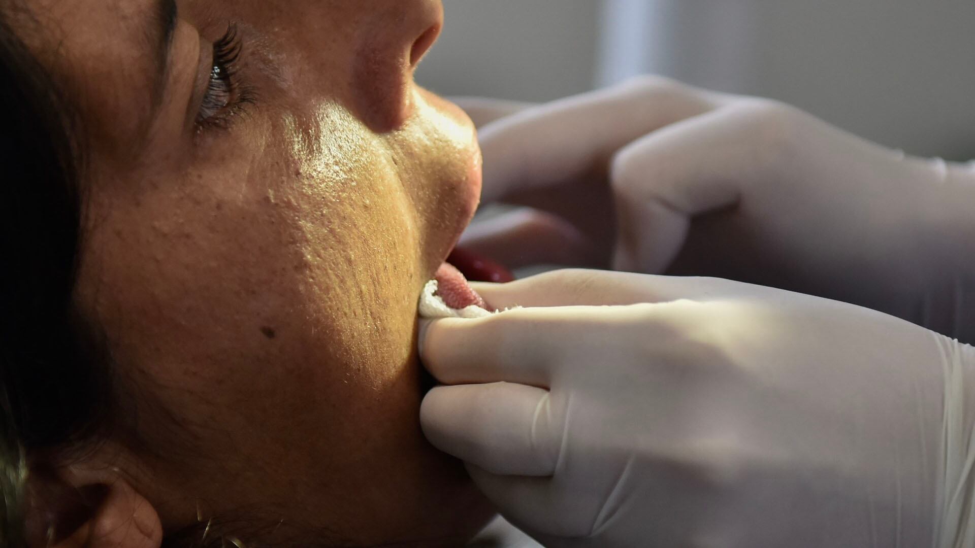 Especialistas advierten que no existe un nivel seguro de consumo de alcohol respecto al cáncer bucal, desmitificando los supuestos beneficios del consumo moderado (Adrian Escandar)