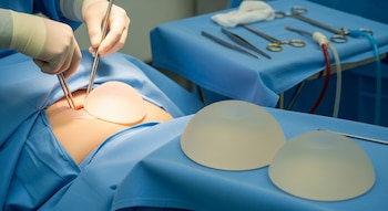 El aumento de mamas es una cirugía que utiliza implantes para incrementar el tamaño o modificar la forma de los senos, según explica Mayo Clinic - crédito Visuales IA