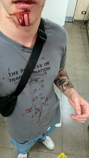 Así quedó Álvaro tras el