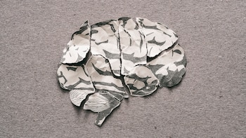 Los investigadores observaron escáneres cerebrales