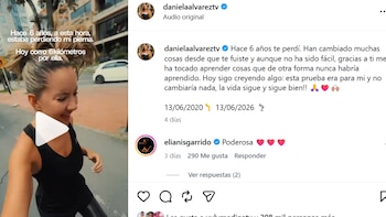 Daniela Álvarez compartió un emotivo video con motivo del sexto aniversario de su amputación, reflexionando sobre las lecciones aprendidas y su proceso de adaptación - crédito @danielaalvareztv/ Instagram