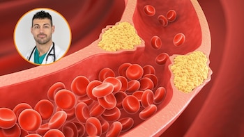 José Abellán, cardiólogo: “Los edulcorantes han demostrado más riesgo de generar placas de colesterol en las bacterias”