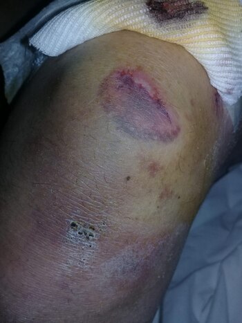 Uno de los golpes en