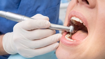 Una mano con guante blanco sostiene un instrumento rotatorio con fresa dental y salida de agua dentro de la boca abierta de una persona.