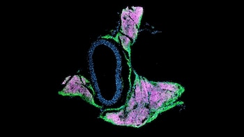 La imagen muestra cómo la