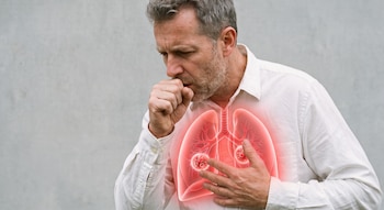 Hombre caucásico de mediana edad tosiendo, con la mano derecha en la boca, viste camisa blanca. Sobre su torso se superpone una imagen de pulmones con inflamación