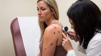 Una médica con bata blanca examina el hombro de una mujer sentada con un dermatoscopio. La mujer tiene múltiples lunares y pecas.