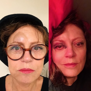 Las fotos de Susan Sarandon completamente desfigurada tras sufrir una caída