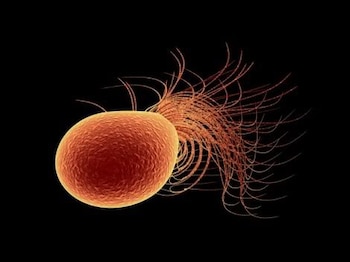 El arqueón Pyrococcus furiosus, cuyo