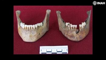 Análisis de restos dentales arrojan