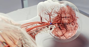 El control del microrobot combina