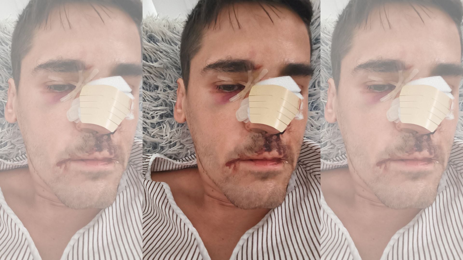 El periodista Fonsi Loaiza recibe una paliza en plena calle en Cádiz y lo dejan inconsciente: “Lo último que recuerdo es que me llamaron ‘rojo, subcampeón’”