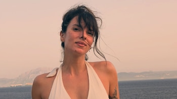Gimena Accardi habló sin filtros sobre los tratamientos estéticos y su presente a los 41 años: "No tengan miedo"
