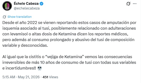 Un estudio reciente reveló que jóvenes sin antecedentes cardíacos sufrieron lesiones valvulares graves tras el consumo repetido de tusi - crédito @echelecabeza / X