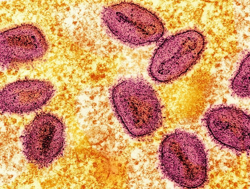 La incautación de viales de mpox desactivado en el aeropuerto de Detroit involucra a dos científicos estadounidenses que omitieron declarar los materiales biológicos (NIAID/Cedida a REUTERS)