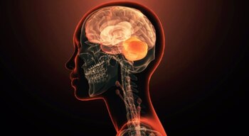 Imagen 34ITWUOOHFCYNHONJYJICNFTEQ