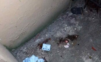 El menor sufrió múltiples fracturas