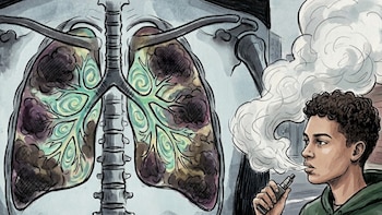 El vapeo podría aumentar el riesgo de cáncer de pulmón, advierten investigadores