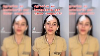 Una camarera sufre una agresión