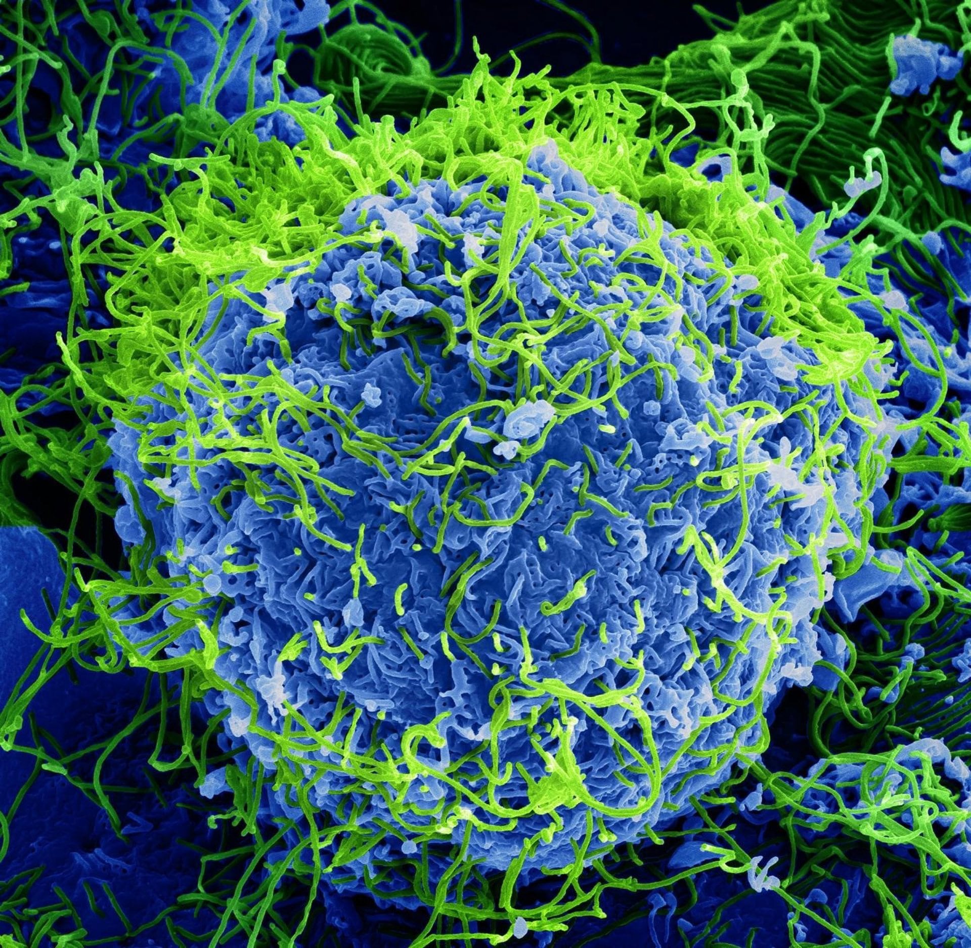 11/02/2019 Micrografía electrónica de barrido coloreada de partículas del virus del Ébola (verde) que brotan y se adhieren a la superficie de las células.POLITICA ESPAÑA EUROPA MADRID SALUDNATIONAL INSTITUTE OF ALLERGY AND INFECTIOUS DISEA