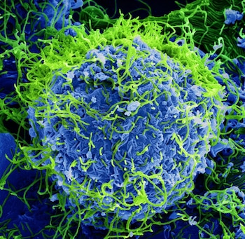 11/02/2019 Micrografía electrónica de barrido coloreada de partículas del virus del Ébola (verde) que brotan y se adhieren a la superficie de las células.
POLITICA ESPAÑA EUROPA MADRID SALUD
NATIONAL INSTITUTE OF ALLERGY AND INFECTIOUS DISEA