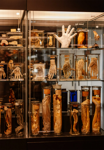 Vitrina de cristal con múltiples frascos conteniendo especímenes anatómicos preservados de manos, antebrazos y otras partes, y un molde blanco de mano