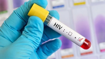 El Salvador registra 229 casos nuevos de VIH en el primer trimestre de 2026: el 85 % afecta a hombres