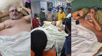 Hilsaca padecía una enfermedad renal crónica en etapa terminal, según las autoridades del hospital. El paciente recibió tratamiento de diálisis durante su proceso de atención médica. (Foto: Cortesía)