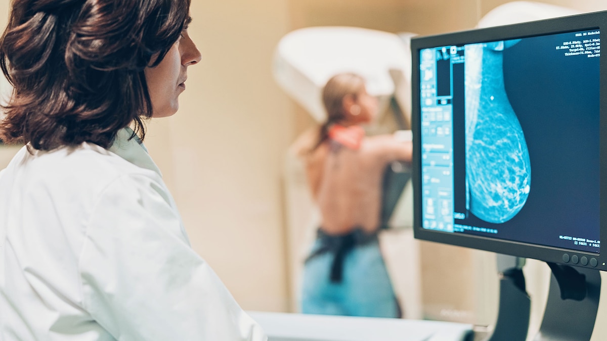 Los últimos avances en mamografías que mejoran la detección de tumores: imágenes en 3D e inteligencia artificial