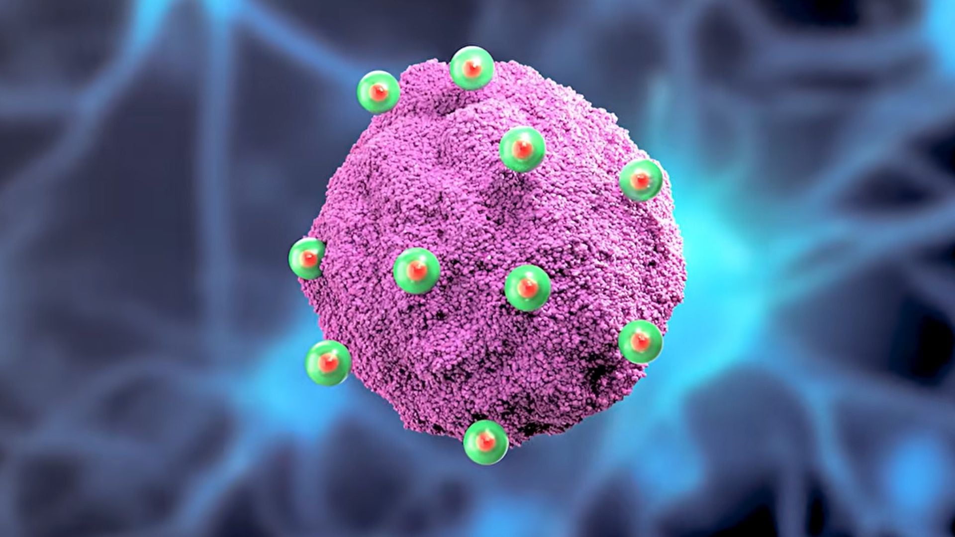 El MIT desarrolló nanoantenas inyectables que eliminan células de glioblastoma resistentes a los fármacos sin dañar el tejido cerebral sano (Yt: @MIT Media Lab)