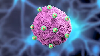 El MIT desarrolló nanoantenas inyectables que eliminan células cancerosas de glioblastoma sin efectos adversos