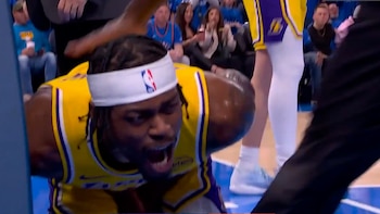 La escalofriante lesión que sufrió un jugador de la NBA después de golpear con su mano en el tablero