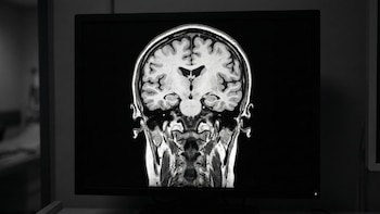 La competencia entre regiones cerebrales es clave para la memoria y la atención, reveló un nuevo estudio