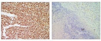 Tumor no tratado (izquierda) comparado