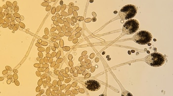 La identificación de genes que