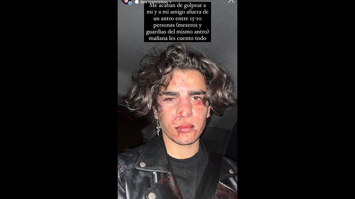 Foto del día de la agresión. (Redes sociales)