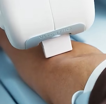 Un dispositivo médico blanco con el texto Vitestro grabado, colocado sobre la piel del brazo de una persona