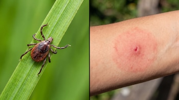 Composición con una garrapata sobre una brizna verde a la izquierda y una lesión circular roja sobre la piel de un brazo humano a la derecha.