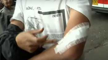 Esta fue la herida que el hombre con machete le provocó al repartidor - crédito captura de pantalla City Tv