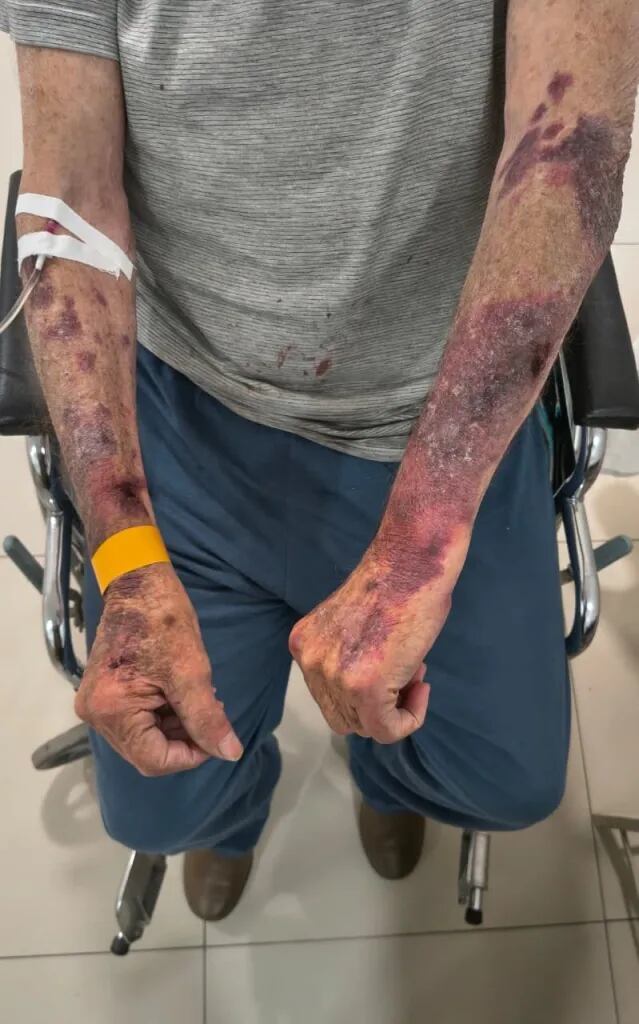 El hombre fue dado de alta, luego de que fuera atendido en un centro de salud privada (Gentileza: Ahora Mar del Plata)