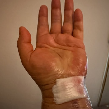 Aparentemente la cirugía no tuvo