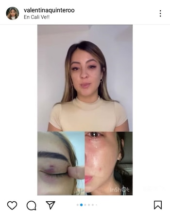 El influenciador caleño Johan Bello