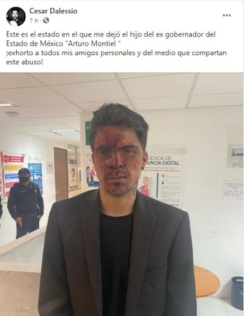 D'alessio reveló que su novia