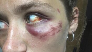 Una de las tantas veces